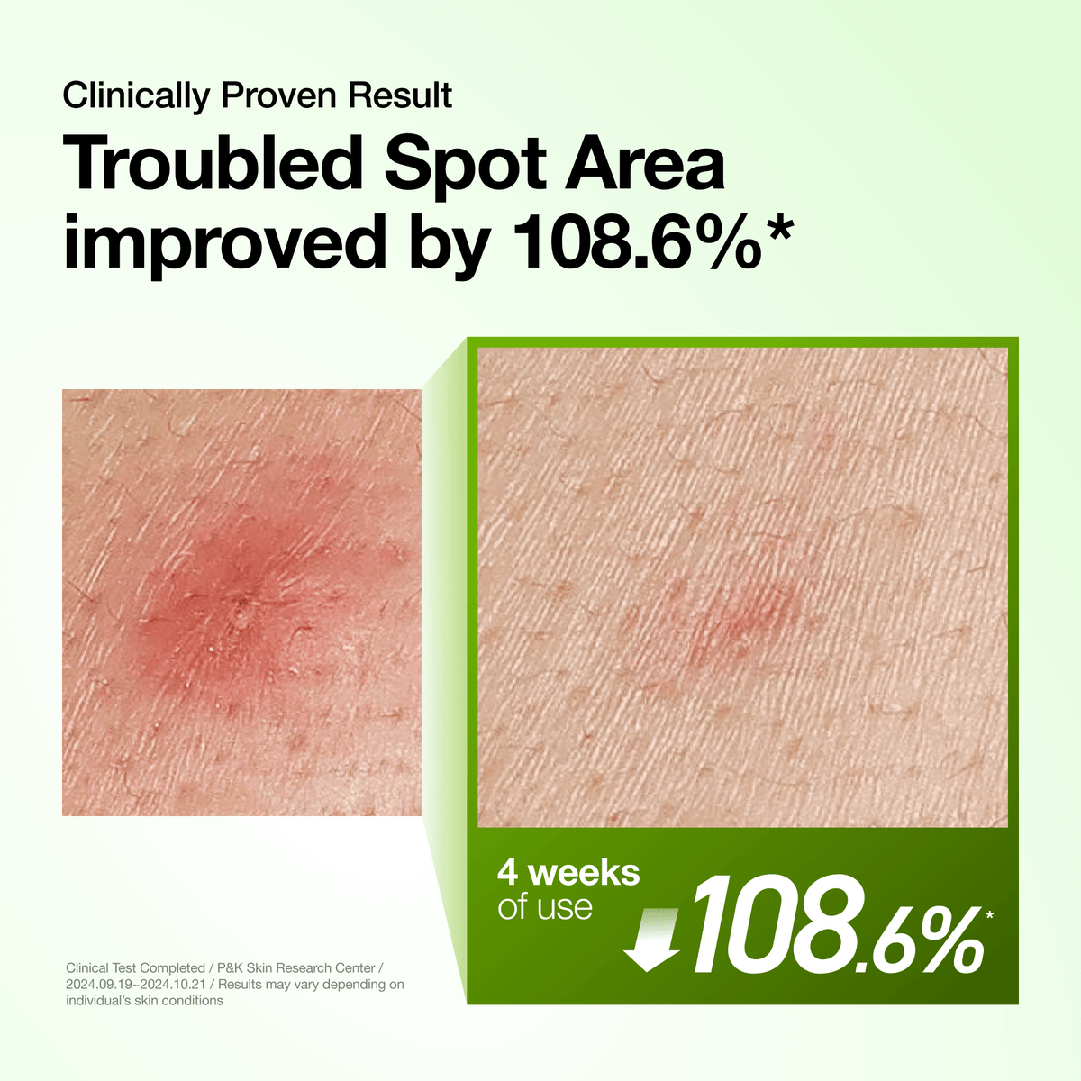 Recharge Your Summer Skin Set