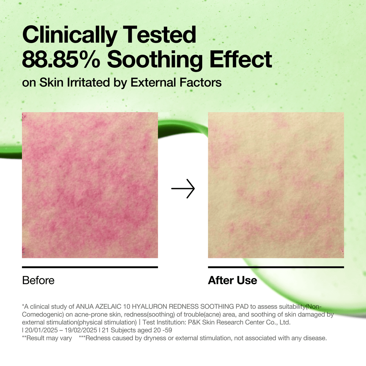 Clear Skin Essentials Set