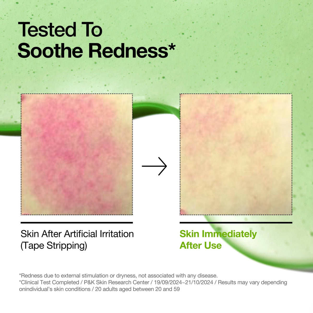 Skin Recovery Duo